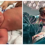 To μωρό που γεννήθηκε έξι κιλά και έγινε viral