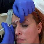 Η Σίσσυ Χρηστίδου κάνει botox και το δείχνει on camera