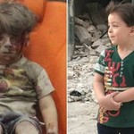 Ο Ομράν Ντακνίς ένα χρόνο μετά το βομβαρδισμό στο Χαλέπι