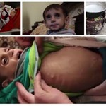 Τα παιδιά της Συρίας νηστικά, ξυπόλητα και… θλιμμένα 