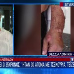 Σοκάρει ο 35χρονος: «Ήταν 30 άτομα με τσεκούρια, τέιζερ και πυρσούς»