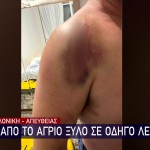 Θεσσαλονίκη: 20χρονοι Ξυλοκόπησαν Άγρια Οδηγού Λεωφορείου