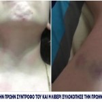 Θεσσαλονίκη: Θύμα ξυλοδαρμού 23χρονη μητέρα βρέφους από τον πρώην σύντροφο