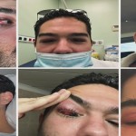 Παγώνη για λοίμωξη Μάστορα:«Δύσκολη περίπτωση, σιγά σιγά θα αντιμετωπιστεί»