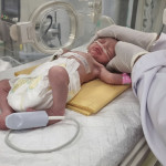 Γάζα: Μωρό Γεννήθηκε Με Καισαρική