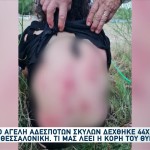 Θεσσαλονίκη: Άγρια Επίθεση Αγέλης Σκύλων Σε 44χρονη Μητέρα