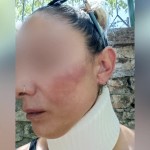 Λέσβος: Η Σύντροφος Του Πυροσβέστη Για Τον Ξυλοδαρμό