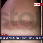 Χαλκιδική: Ξυλοκόπησε Τη Σύζυγό Του Για Ένα Story