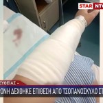 Χαλκιδική: Τσοπανόσκυλο Επιτέθηκε σε 39χρονη
