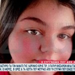 Θάνατος 14χρονης Γωγώς: Ο Πατέρας Της Ζητά Δικαίωση