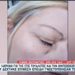 Θεσσαλονίκη: Χτύπησαν Μητέρα 14χρονου Σε Σχολείο