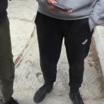 Πάτρα: Ανήλικοι Ρομά Επιτέθηκαν Και Δάγκωσαν 13χρονο