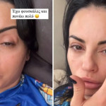 Δήμητρα Αλεξανδράκη: Έπαθε Αλλεργική Αντίδραση Από Σούσι