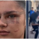 Πάτρα: Ξεσπά Η 18χρονη Για Την Επίθεση Που Δέχθηκε Στο ΕΠΑΛ