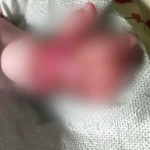Βόλος: Ίσως Νεκρωθεί Το Χεράκι Του Βρέφους