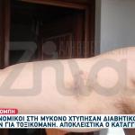 Μύκονος: Ξυλοδαρμός Διαβητικού Από Αστυνομικούς