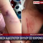 Άγρια Επίθεση Αδέσποτου Σκύλου Σε 10χρονη Στη Σκύδρα