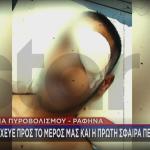 θύμα πυροβολισμού στη Ραφήνα