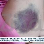 Με Έδερνε Ο Σύντροφός Μου Γιατί Του Έφτιαχνα Καφέ