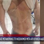Βόλος: Στο νοσοκομείο 7χρονος μετά από επίθεση σκυλιών