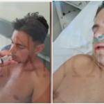 Βόνιτσα: Ξυλοκόπησαν 18χρονο - Του Έσπασαν Το Σαγόνι