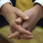 Τι Είναι Η Χρόνια Φλεβική Ανεπάρκεια Που Πάσχει Ο Τραμπ