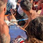 Δονούσα: Κοντάρι Ομπρέλας Καρφώθηκε Σε Λουόμενη