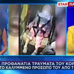Παλαιό Φάληρo: Πού Βρίσκονται Τα Προθανάτια Τραύματά Της