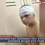 Θεσσαλονίκη: 13χρονος Δέχθηκε Άγρια Επίθεση