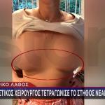 Τι Λέει Η 30χρονη Που Πλαστικός Της Τετραγώνισε Το Στήθος