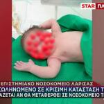 Καρδίτσα: Mε Βαριά Εγκαύματα Σε Πρόσωπο Και Σώμα Το Βρέφος