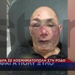 Ενέδρα Σε Κοσμηματοπώλη Στη Ρόδο: «Έφαγα Πολύ Ξύλο»