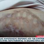 Με Έκαιγε Στο Καλοριφέρ: Τα Βασανιστήρια Της Μαρίας