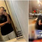 Κατέληξε ο 22χρονος που είχε καταπιεί ολόκληρο μπέργκερ