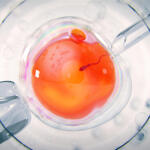 Επτά Κλινικές Στην Ελλάδα Χρησιμοποίησαν Σπέρμα Του Δότη