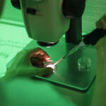 Δανός Δότης: Πότε Γεννήθηκε Το Τελευταίο Παιδί Στην Ελλάδα