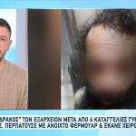 Συνελήφθη Ο Δράκος Των Εξαρχείων