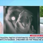 Κολωνάκι: Ποινική Δίωξη Σε Βάρος Της Τραγουδίστριας