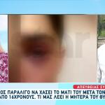 Ιωάννινα: Ο 16χρονος Που Ξυλοκοπήθηκε Έχει Θυμό