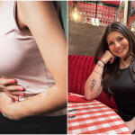 Τα Συμπτώματα Του Καρκίνου Του Παχεός Eντέρου