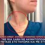 Λήμνος αγροτική γιατρός