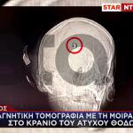 Άργος πυροβολισμοί