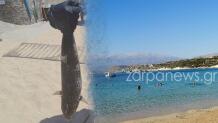 Πάτρα: Γυναίκα Ισχυρίζεται Ότι Τη Δάγκωσε Λαγοκέφαλος