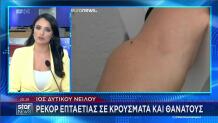 Ιός Δυτικού Νείλου
