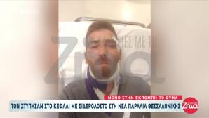 Θεσσαλονίκη: Τον Χτύπησαν Με Σιδηρολοστό Στο Κεφάλι