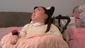 Κορίτσι Γεννήθηκε Χωρίς Εγκέφαλο Και Ζει 20 Χρόνια!