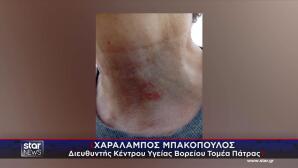 Πάτρα: Γυναίκα Ισχυρίζεται Ότι Τη Δάγκωσε Λαγοκέφαλος