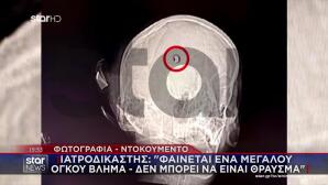 Άργος:Ένας Αστυνομικός Παραδέχεται Ότι Πυροβόλησε Στον Τοίχο