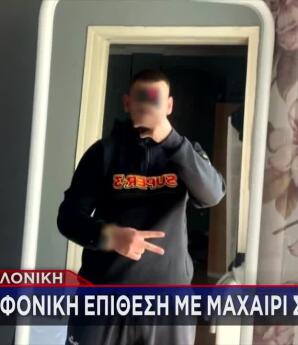 Θεσσαλονίκη: Αυτός Είναι Ο 23χρονος Δράστης