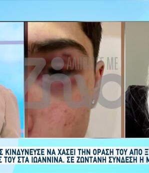 Ιωάννινα: Ανήλικοι Χτύπησαν 17χρονο - Θα Έχανε Το Μάτι Του